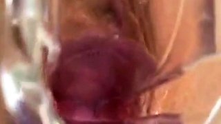 Girl's Tiring Doctor Visit: A Webcam Capture