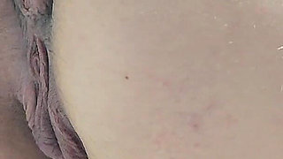 Pissing with a Huge Hemorrhoid in My Asshole Anal Problems